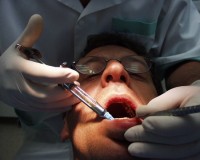 חלום על מקקים? יש שיעדיפו טיפול שורש אצל רופא שיניים מאשר מפגש עם ג'וק